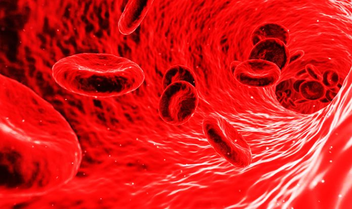 Pembuluh darah pecah selama ini lebih sering dikaitkan dengan stroke. Kondisi ini juga umumnya dikaitkan dengan kondisi yang berbahaya.