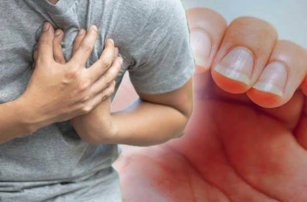 Deteksi penyakit jantung lewat jari merupakan salah satu cara untuk mendeteksi seseorang terkena penyakit jantung atau tidak. Ini karena kondisi jari beserta kuku-kukunya bisa menjadi cerminan kesehatan seseorang, termasuk kesehatan jantung.